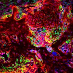 Histology image with stem cells labeled in red and skull region in green