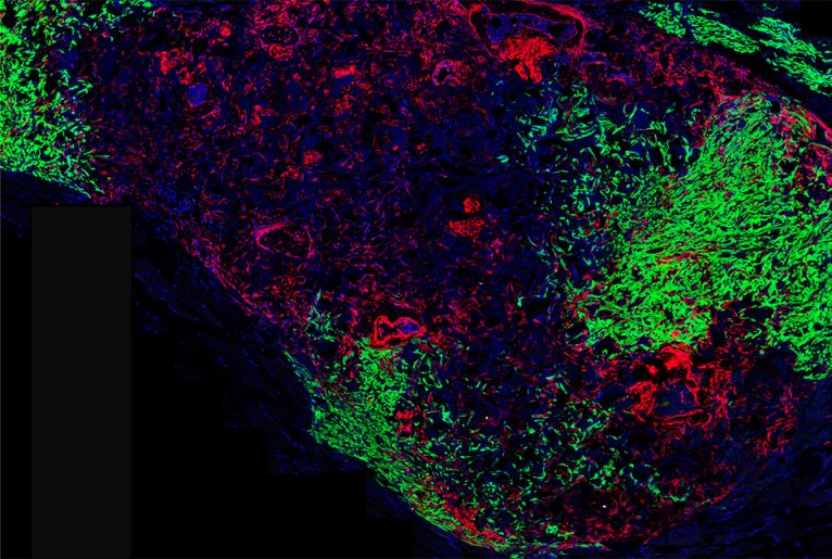 green and red labeled cells in immunofluorescent image