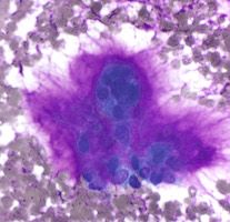 cytopathology cells